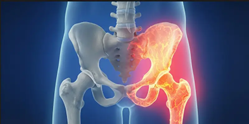 Fibröz Displazi Nedir? Türleri, Belirtileri ve Tedavisi