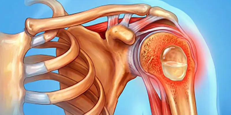 Kemik Kisti Nedir? Tedavileri Nelerdir?