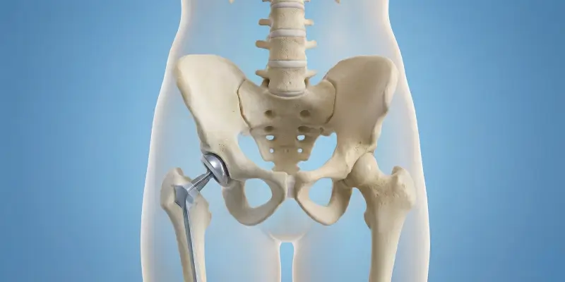 Robotik Diz ve Kalça Protezi